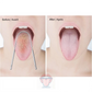 LanguaCare Stainless Steel Tongue Scraper