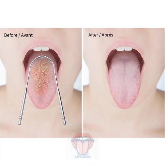 LanguaCare Stainless Steel Tongue Scraper